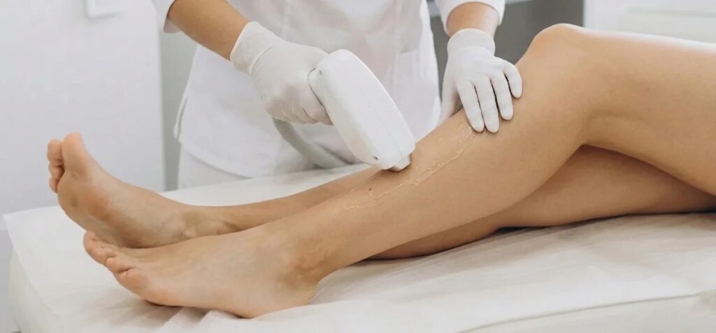 Dauerhafte Haarentfernung am Bein mit medizinischem Diodenlaser bei MA Beauty in Wettingen